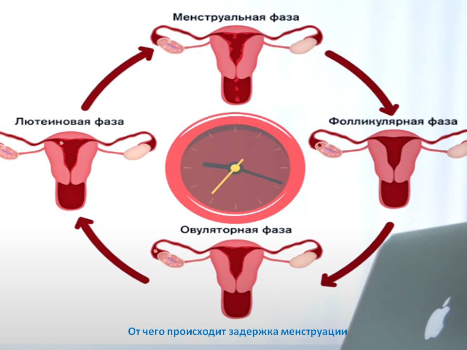 От чего происходит задержка менструации